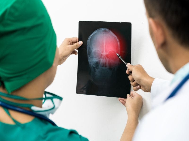 Photo of two doctors looking at a head x-ray